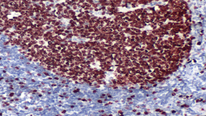 What The Ki67 Antibody Is Used For And Why