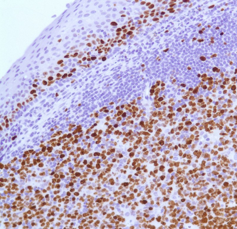 Learn How To Use The KI67 Antibody